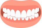 Overbite