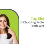 top benefits of choosing professional teeth whitening