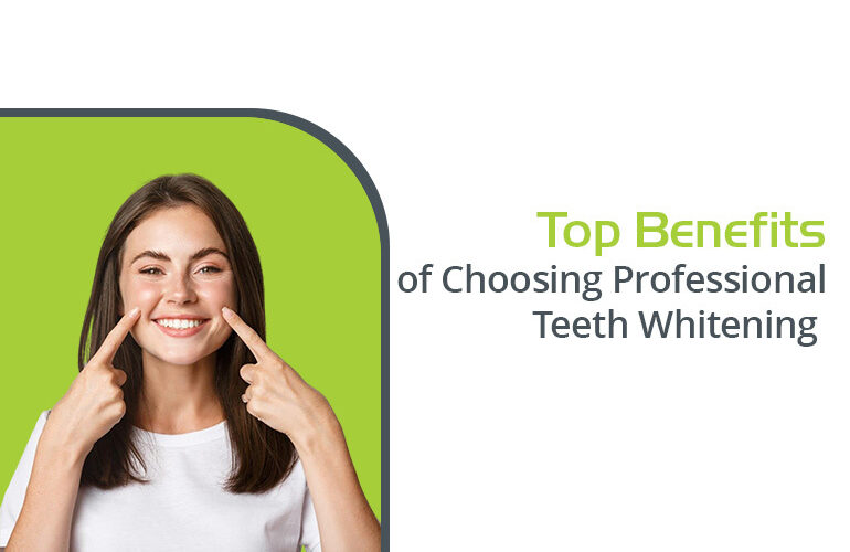 top benefits of choosing professional teeth whitening
