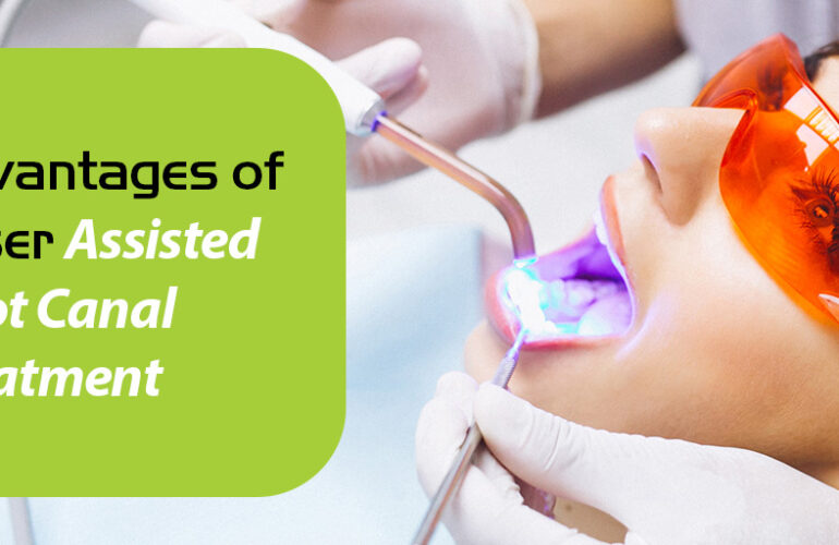 laser assisted root canal treatment