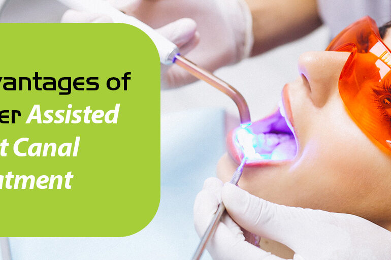 laser assisted root canal treatment