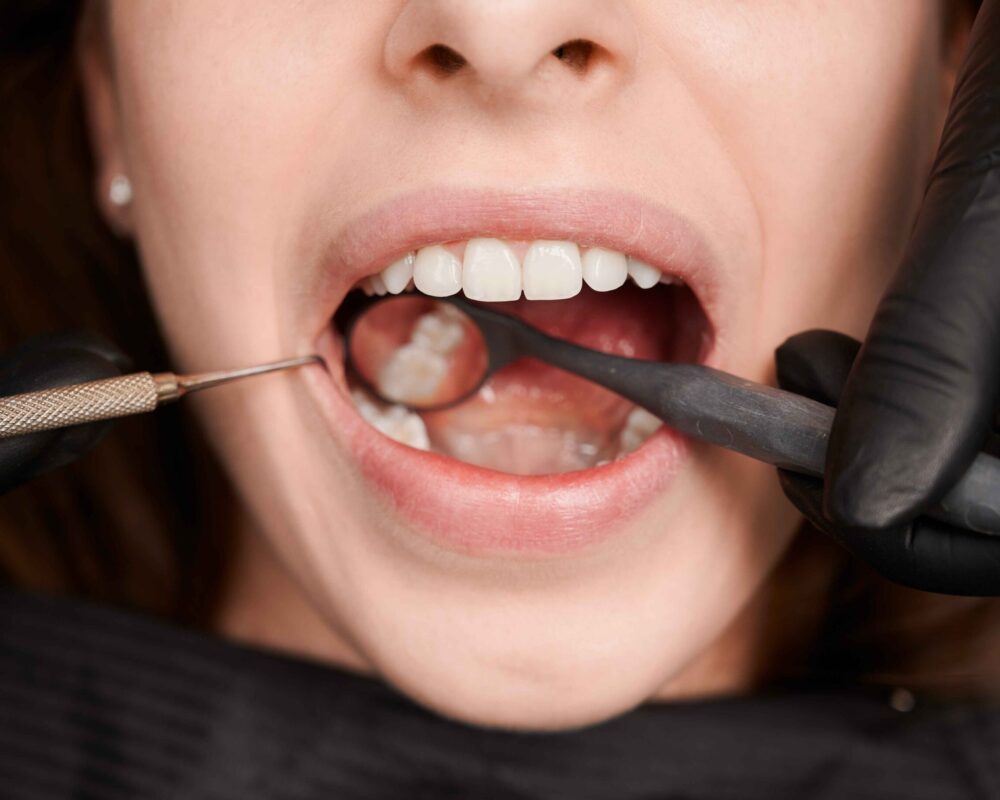 mini-molar-img mini-molar-img