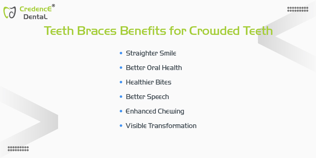 dental braces for crowded teeth