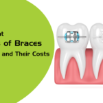 different types of braces in india and their cost