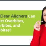 how clear aligners can correct overbites underbites and crossbites