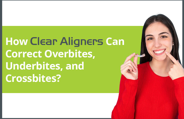 how clear aligners can correct overbites underbites and crossbites