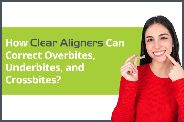 how clear aligners can correct overbites underbites and crossbites