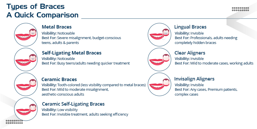 types of braces in india
