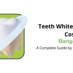 teeth whitening cost in bangalore