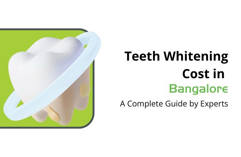 teeth whitening cost in bangalore