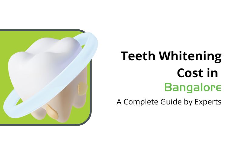 teeth whitening cost in bangalore