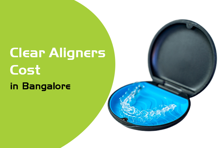 clear aligners cost in bangalore