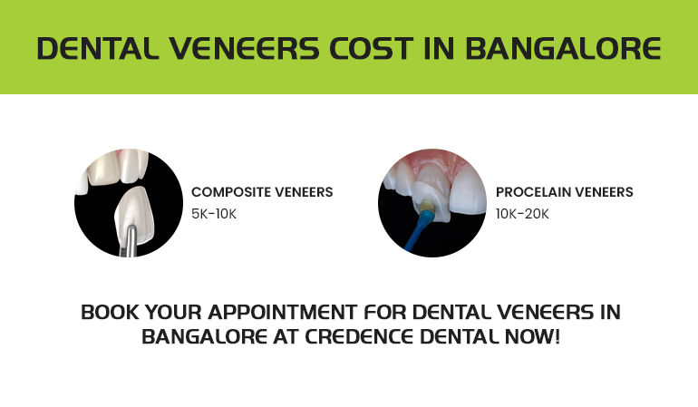 dental veneers cost in bangalore