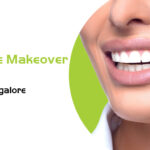 smile makeover cost