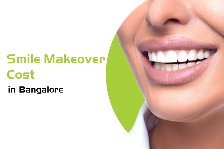 smile makeover cost