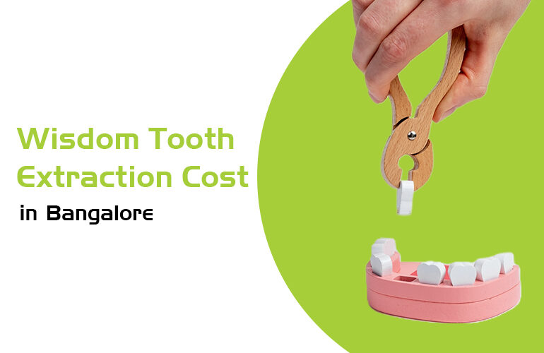 wisdom tooth extraction cost in bangalore