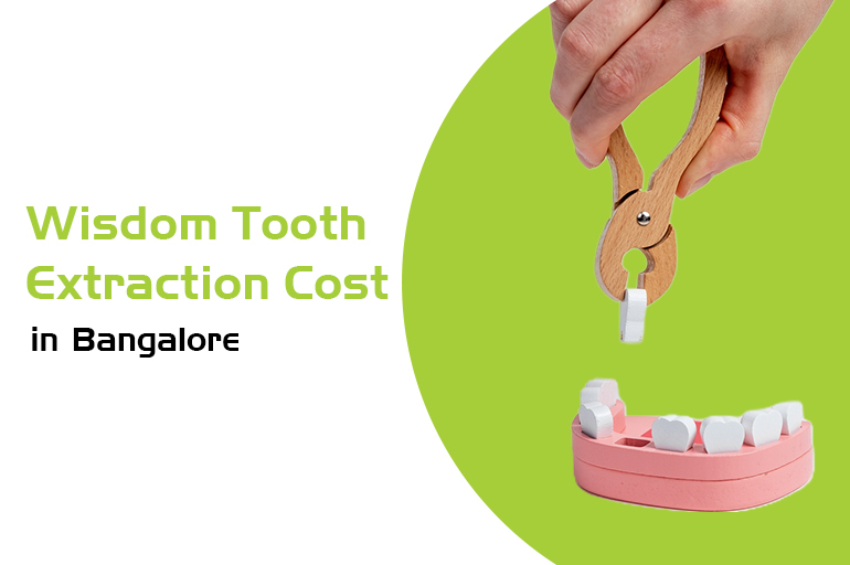 wisdom tooth extraction cost in bangalore