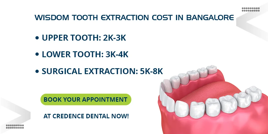wisdom-tooth-extraction-cost-in-bangalore
