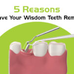 5 reasons to have your wisdom teeth removed
