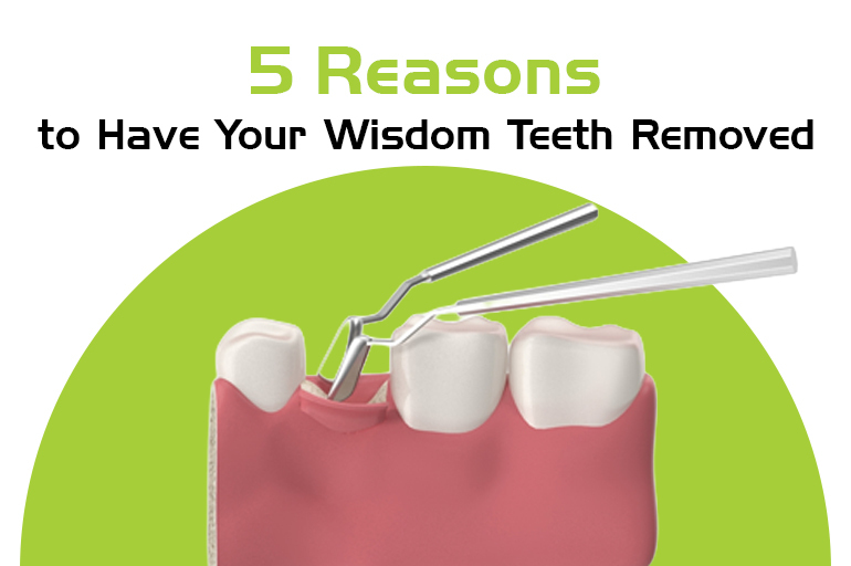 5 reasons to have your wisdom teeth removed