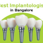 best implantologist in bangalore