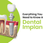 credence-dental-implant