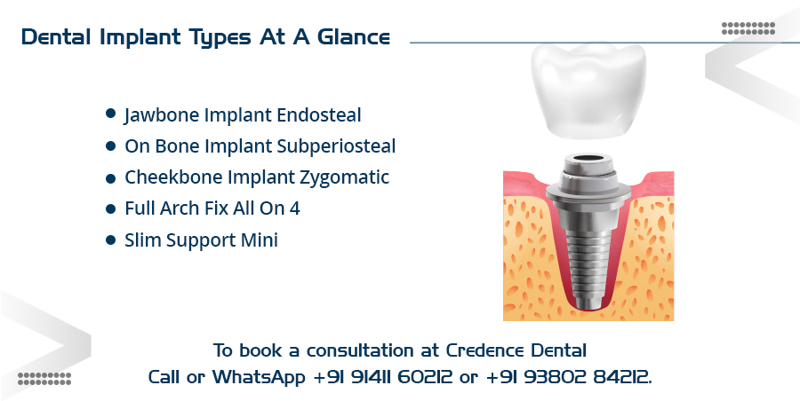 dental implant types at a glance