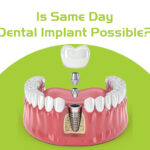 is same day dental implant possible