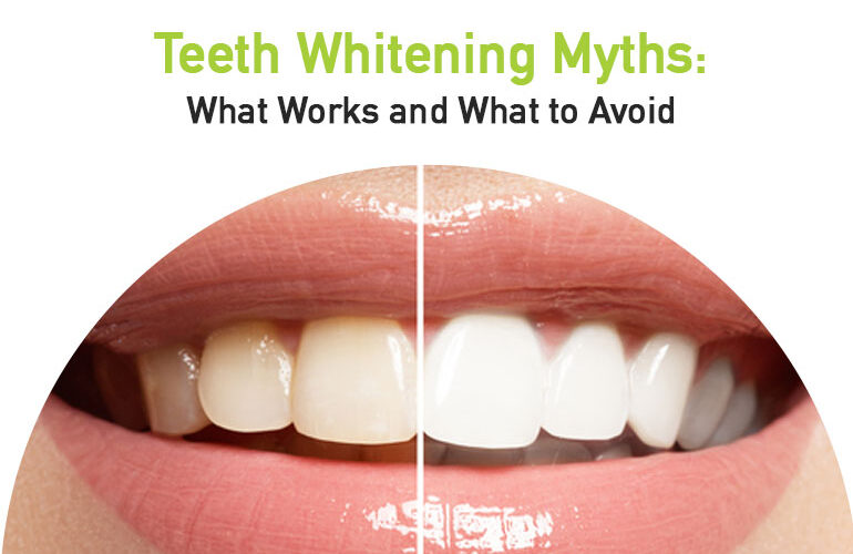 teeth whitening myths what works and what to avoid