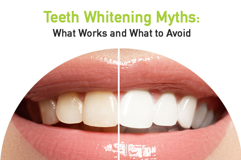 teeth whitening myths what works and what to avoid