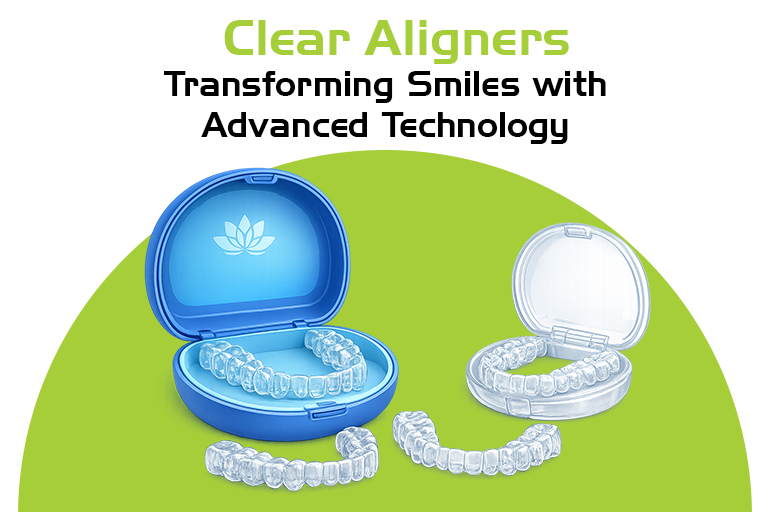 clear aligners transforming smiles with advanced technology