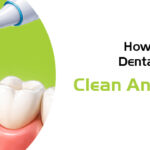 dental implant clean