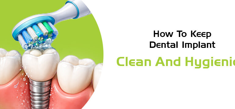 dental implant clean