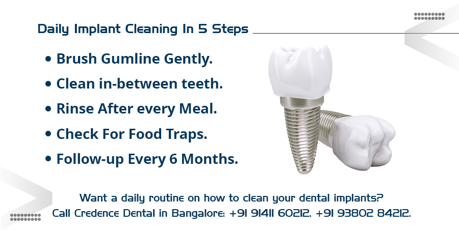 daily implant cleaning in 5 steps