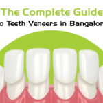 teeth veneers in bangalore