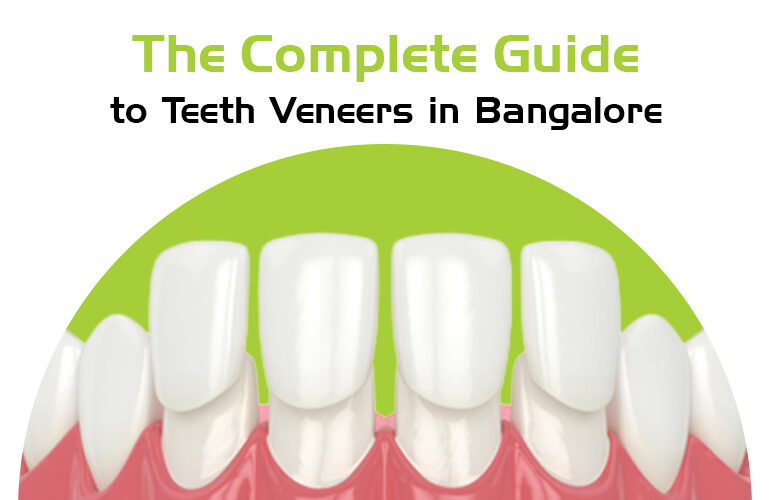 teeth veneers in bangalore