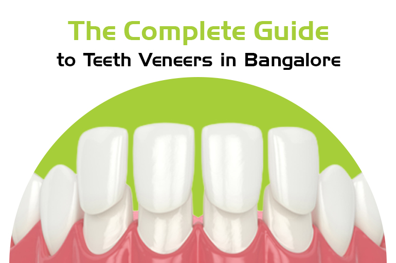 teeth veneers in bangalore