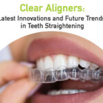 clear aligners in Bangalore