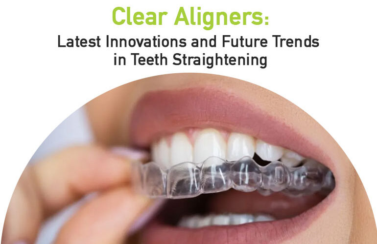 clear aligners in Bangalore