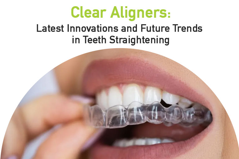 clear aligners in Bangalore
