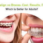 invisalign vs braces