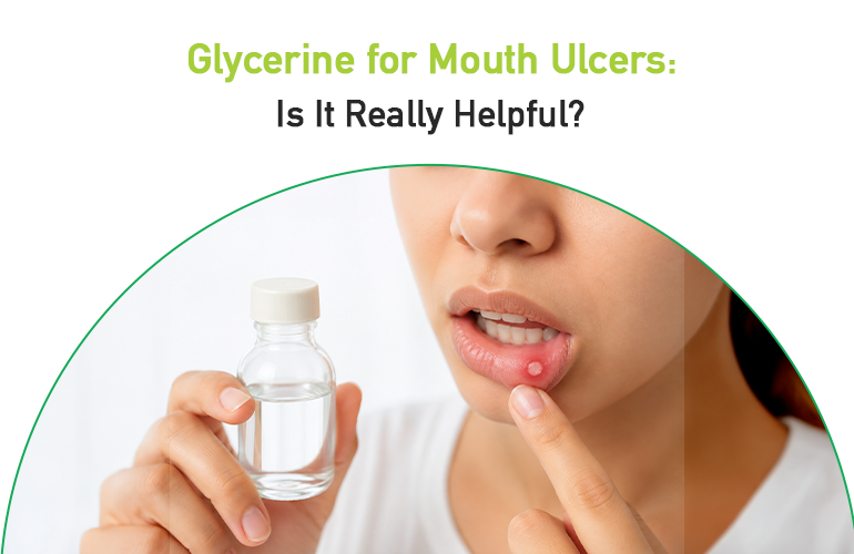 glycerine for mouth ulcers- is it really helpful