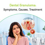 dental granuloma: symptoms, causes, treatment
