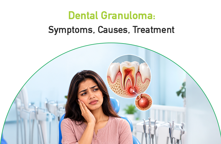 dental granuloma: symptoms, causes, treatment