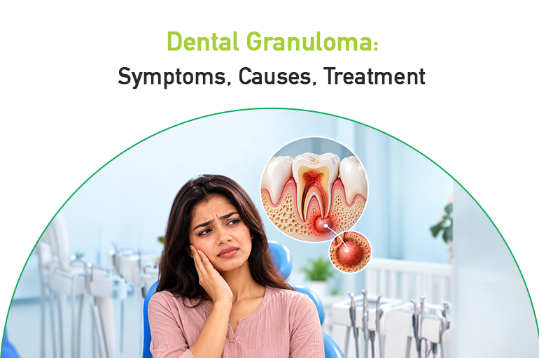 dental granuloma: symptoms, causes, treatment